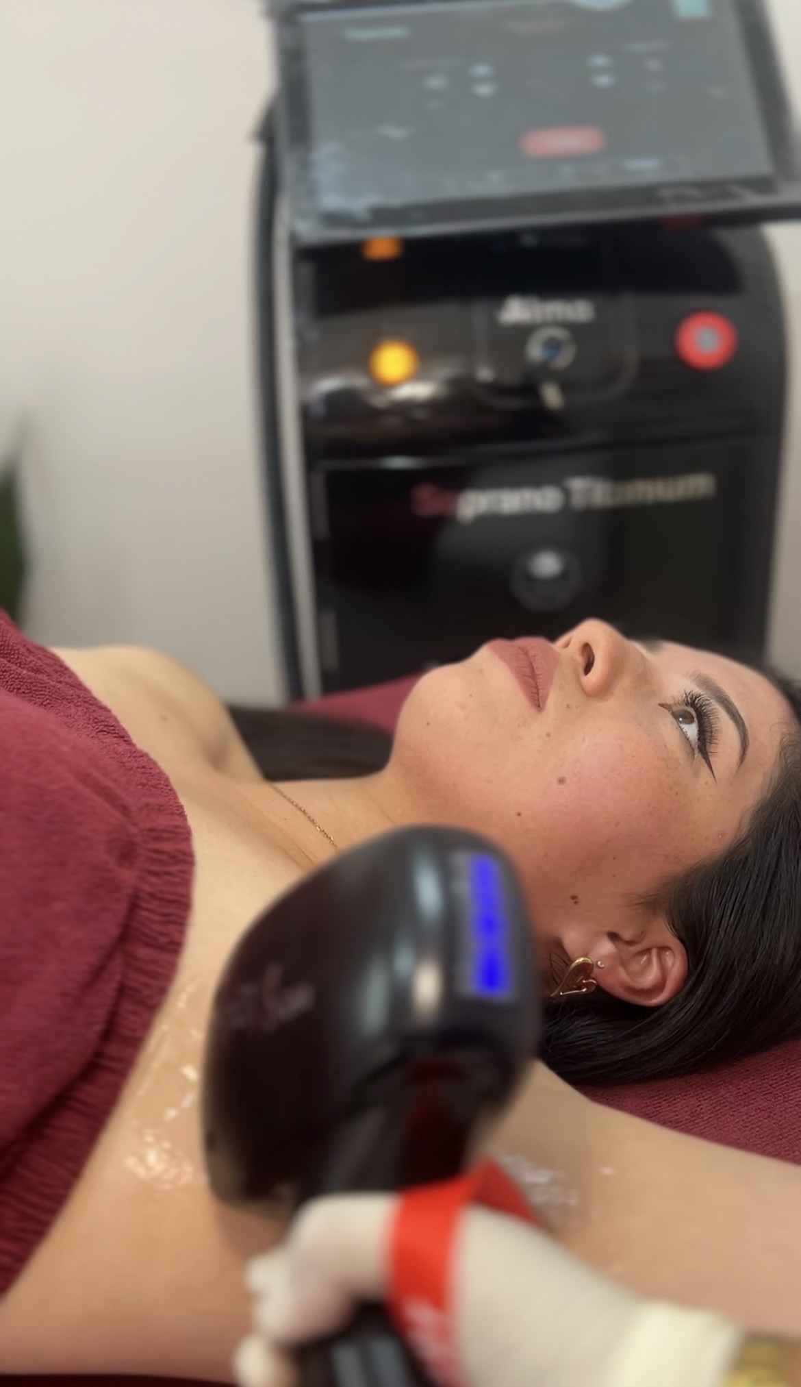 Depilacion laser en zona de axilas