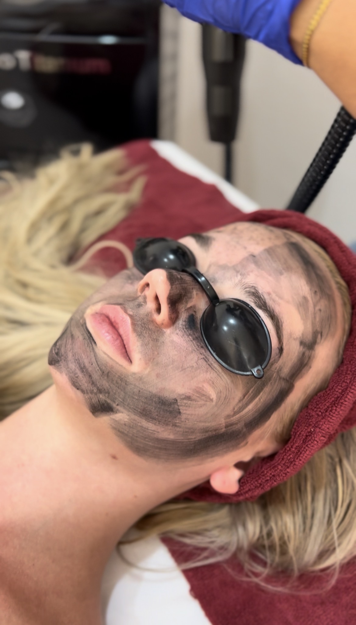Hollywood peel