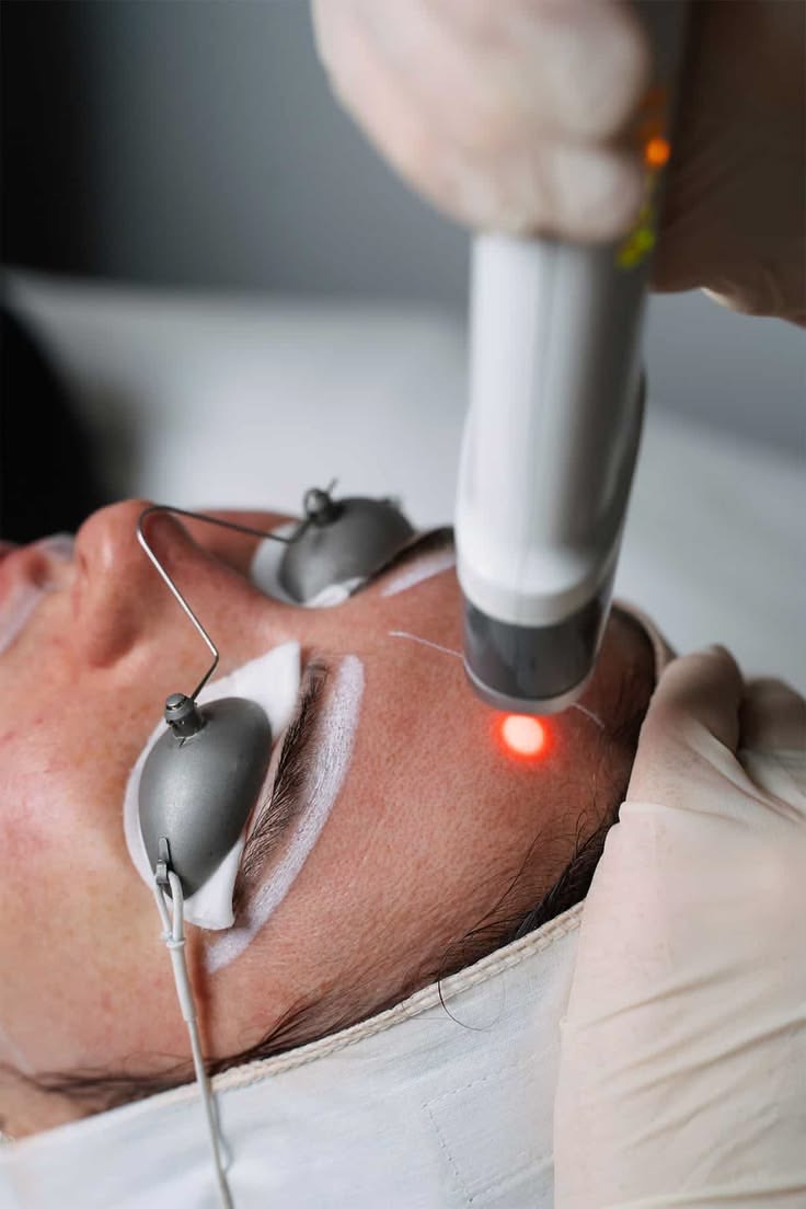 PicoSure